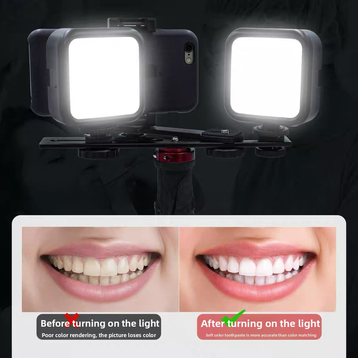 Dental Photography Light with  - đánh giá và giá Photography Mobile Lighting